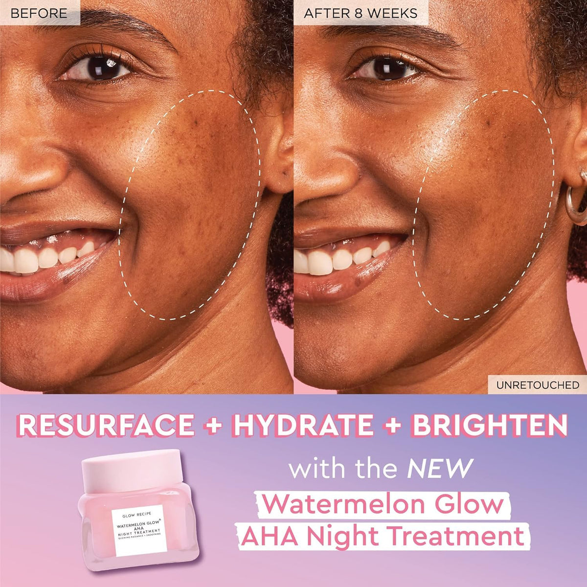 Watermelon PHA + BHA Facial Pore Toner (40 ml) + Niacinamide Dew Drops Brightening Serum (40 ml) + AHA Anti Aging Sleeping Mask (60 ml) V66913